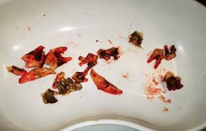 hund fips zahnsanierung zaehne