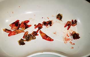 hund fips zahnsanierung zaehne